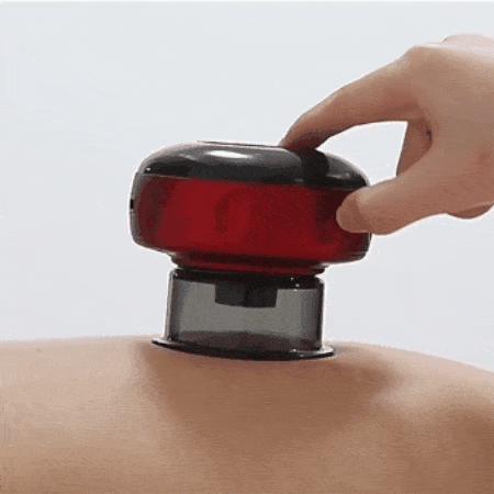 Ventosa Electrica CuppoPro